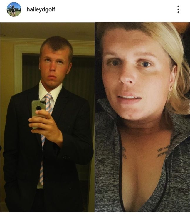 헤일리 데이비드슨의 성전환 수술 이전(왼쪽)과 이후 모습. 출처=데이비드슨 소셜 미디어