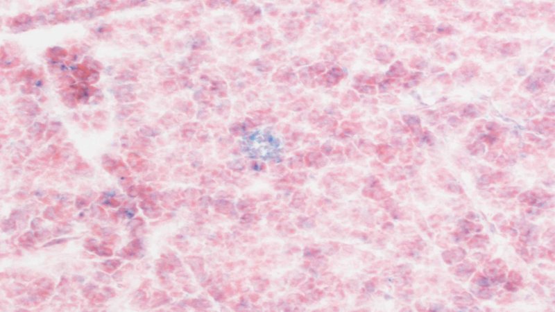 아모르 베가스 박사는 키메라 T 세포가 나이 들수록 축적되는 노화 세포(파란색)를 찾아 파괴하도록 만들었다. 사진은 늙은 실험쥐가 어릴때 키메라 T 세포로 치료받은 뒤 노화세포가 줄어든 췌장 조직 아모르 베가스 제공