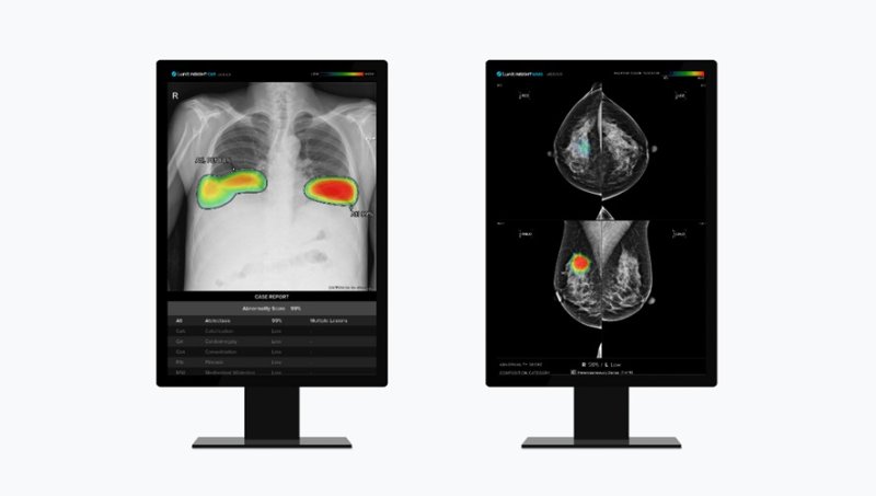 루닛 흉부 엑스레이 AI 영상분석 솔루션 '루닛 인사이트 CXR'(왼쪽) 및 유방촬영술 AI 영상분석 솔루션 '루닛 인사이트 MMG' (사진제공=루닛)/뉴스1