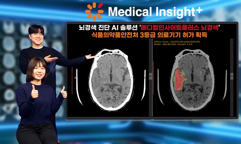 SK C&C 직원이 식품의약품안전처로부터 3등급 의료기기 허가를 받은 뇌경색 진단 AI솔루션 '메디컬인사이트플러스 뇌경색'을 소개하고 있다. SK C&C 제공
