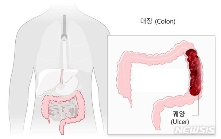 뉴시스