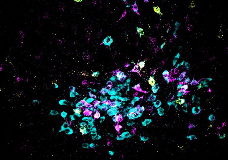 미국 캘리포니아 대학교 샌디에이고 캠퍼스 생물과학부 닉 스피처 교수팀이 뇌의 화학적인 과정과 신경 회로가 어떻게 일반적인 두려움을 일으키는지를 알아냈다. 사진은 뇌의 뉴런이 청록색으로 표시됐으며, 신호 전달 경로를 나타내는 특수한 표지물이 노란색과 붉은 보라색을 띠고 있다. 닉 스피처 교수 제공