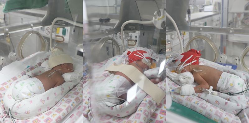 의료 공백에도 세쌍둥이 탄생시킨 계명대 동산병원