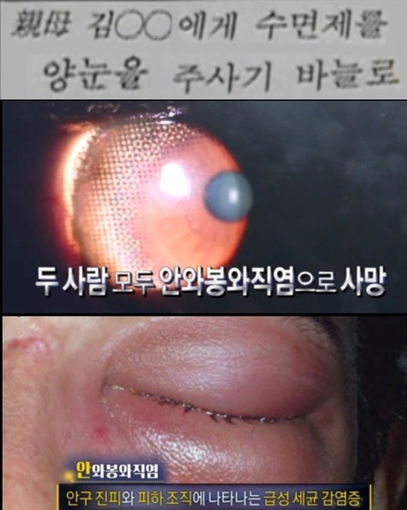 엄인숙은 수면제가 든 주사기로 친어머니 눈을 찔러 실명시키는 가 하면 두명의 남편도 눈을 찔러 실명에 이르게 한 후 그 후유증 등으로 결국 숨지케 했다. (SBS 갈무리) ⓒ 뉴스1