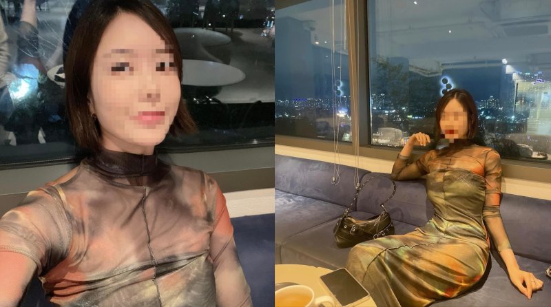 이소라, 충격 근황 "코 수술 후 숨도 못 쉰다"