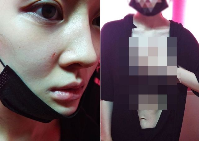 티아라 출신 아름, 전 남편 폭행 주장 사진 공개 "옷 찢고..."