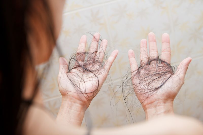 여성들은 정수리 부근 머리카락이 가늘어지면서 밀도가 낮아진다. 모제림성형외과 제공