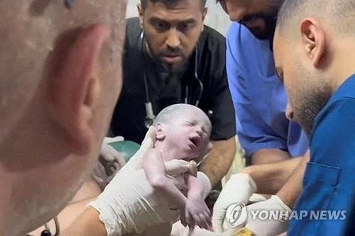 숨진 엄마 배 속에 있던 아기, 제왕절개로 생존 (로이터=연합뉴스) 팔레스타인 가자지구 라파에서 공습으로 숨진 엄마의 배 속에 있던 한 아기가 응급 제왕절개 수술을 통해 극적으로 생명을 건졌다. 사진은 배 속에서 막 나온 아기 모습을 촬영한 로이터TV 영상 캡처. 2024.4.21
