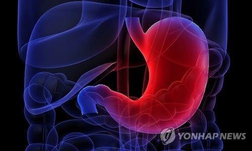 짜게 먹는 식습관, 위암 유발한다