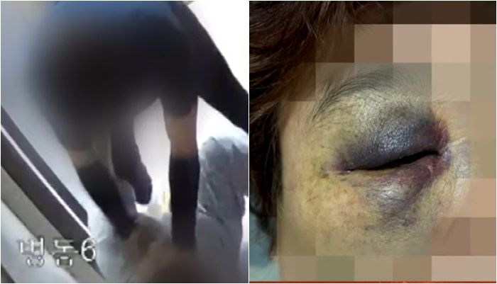 "저 정도면 살인미수급".. 50대 女환자 무차별 폭행한 男보호사 [영상]