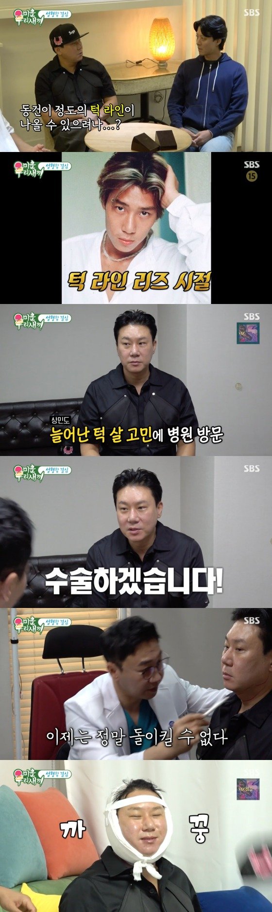 이상민, 턱살 고민에 성형외과 방문…시술 후 부은 얼굴 귀여워 [RE:TV]