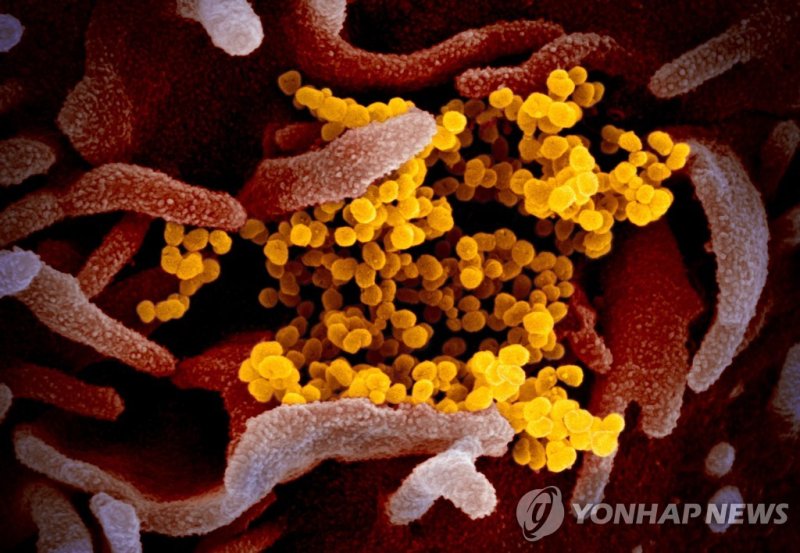 코로나19 여름유행 오나…"미국엔 전국적 확산세 관측" epa08252655 An undated handout picture made available by the National Institutes of Health (NIH) shows a scanning electron microscope image of SARS-CoV-2 (yellow) -- also known as 2019-nCoV, the virus that causes COVID-19 -- isolated from a patient in the USA, emerging