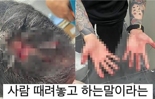 팔로워 39만 20대 틱톡커 "도촬사진 지워 달랬더니 때렸다"