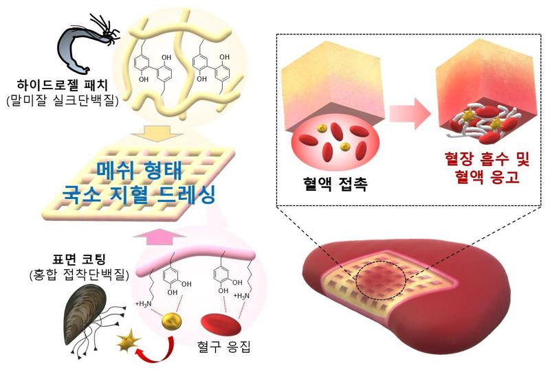 말미잘과 홍합 단백질을 활용한 건조 하이드로젤 메쉬 형태의 흡수성 국소 지혈 드레싱. POSTECH 제공