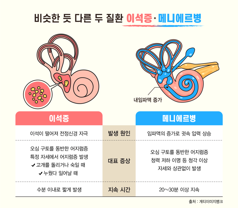 이석증과 메니에르병 비교. 강동경희대병원 제공