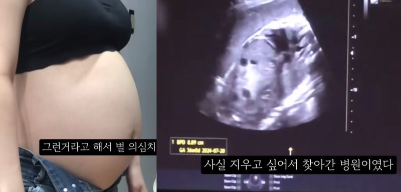 '36주 낙태 영상' 집도의 따로 있었다... 살인 혐의 등으로 8명 입건