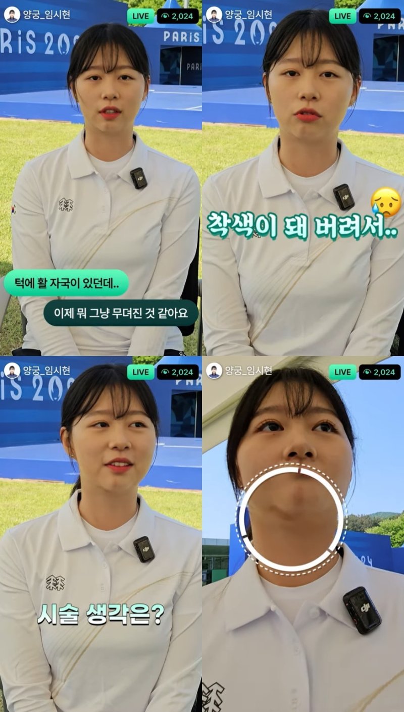 양궁 3관왕 임시현에 턱에... SBS '외모 지적' 논란