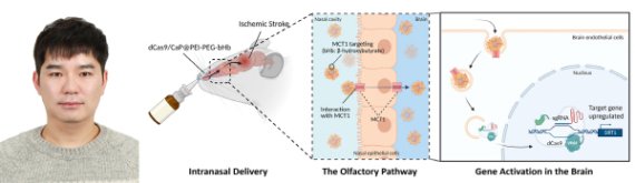 국민대 류일환 박사 연구팀, 비강 통한 허혈성 뇌졸중 치료법 개발