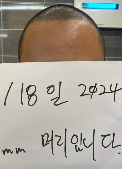 "음식서 머리카락, 환불" 요청에 사장이 공개한 사진