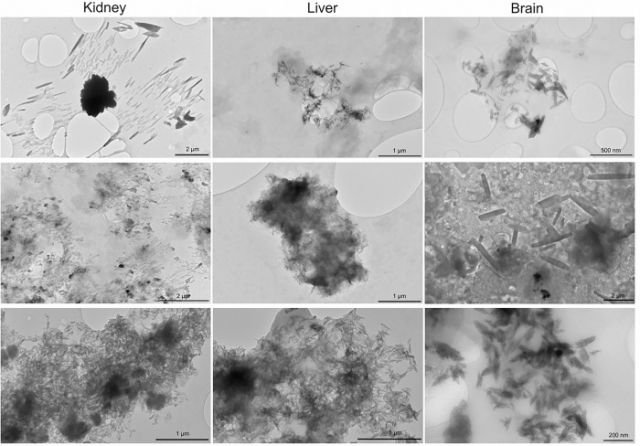 뉴멕시코 대학교 매튜 캠펜 교수 연구팀이 인간의 신장(왼쪽), 간(중앙), 뇌(오른쪽) 샘플에서 추출한 고체 나노입자의 TEM(투과전자현미경) 이미지. 미국 국립보건원(NIH) 홈페이지 캡처