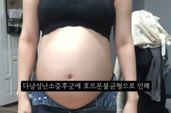 유튜버 A씨는 지난 6월 27일 유튜브에 "임신 36주 차에 낙태 수술을 받았다"며 '낙태 브이로그'를 올렸다. /사진=뉴시스(사진=유튜브 갈무리)