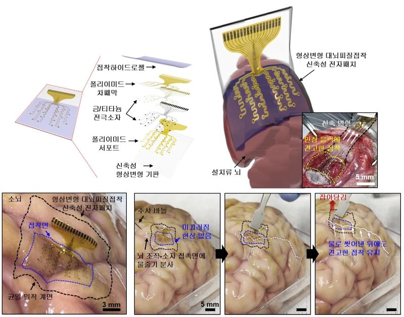 IBS-KIST 공동연구진이 개발한 형상변형 대뇌피질접착 신축성 전자패치는 뇌 조직에 벌어진 틈이 없이 견고하게 달라 붙어 뇌파를 모니터링하고 초음파로 신경을 자극한다. IBS 제공