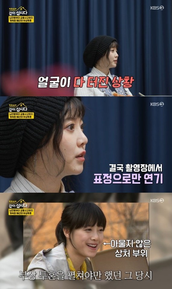 구혜선 "'꽃보다 남자' 당시 뇌진탕→교통사고까지"…투혼 고백