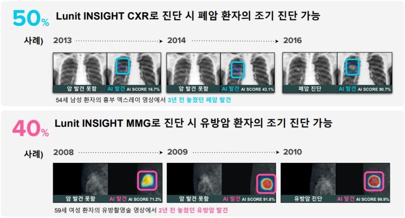 '암 진단율 97%' 의료 AI 루닛 인사이트…전 세계 병원 3800곳서 쓴다