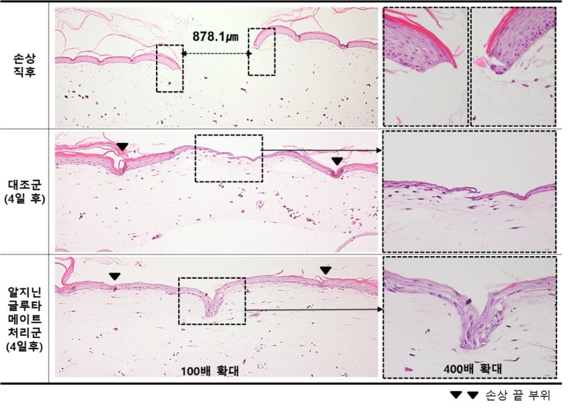 LG생활건강은 인공 피부 손상 후 회복 촉진 평가를 진행한 결과, '알지닌 글루타메이트'를 사용한 실험군이 대조군 대비 최대 2.8배 상처 회복이 빨라지는 것을 확인했다. LG생활건강 제공