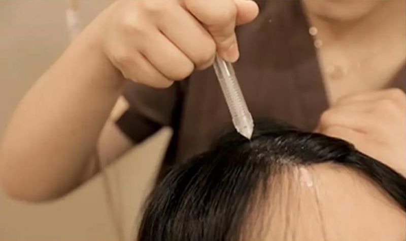 [황정욱의 탈모 백과사전] 가는 머리카락을 굵게 만드는 ‘커피샴푸’ -<끝>