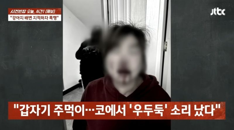 "개 배변 치워" 말했다가 주먹에 '코뼈 골절'…가해자 "쌍방 폭행"