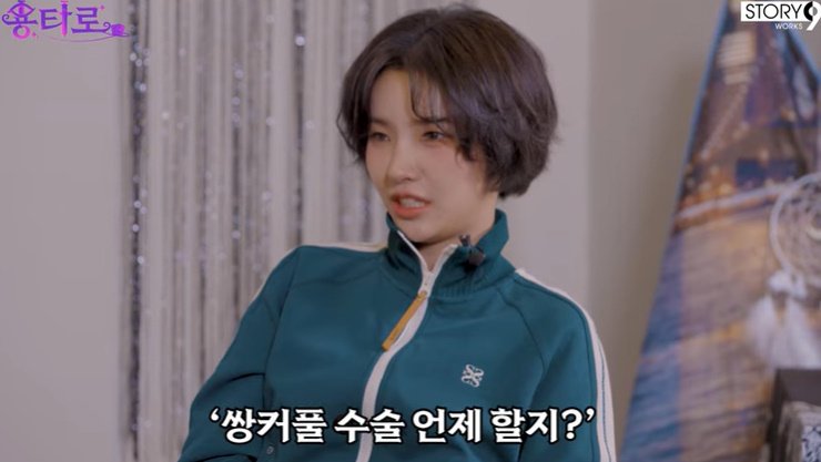 (여자)아이들 소연 "쌍꺼풀 수술할 것…4년 동안 고민해"