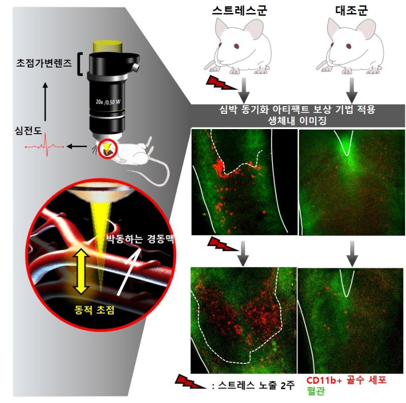 "만성 스트레스, 동맥경화 가속화"…세포 추적영상 규명 