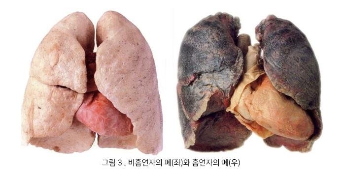 [위클리 건강] 평생 피우고도 건강하다?…"흡연을 위한 변명일 뿐"