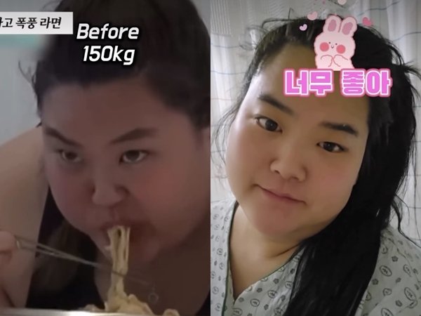 미나 시누이 150㎏→99㎏ "응급실도 갔는데…탈장 수술 받아"