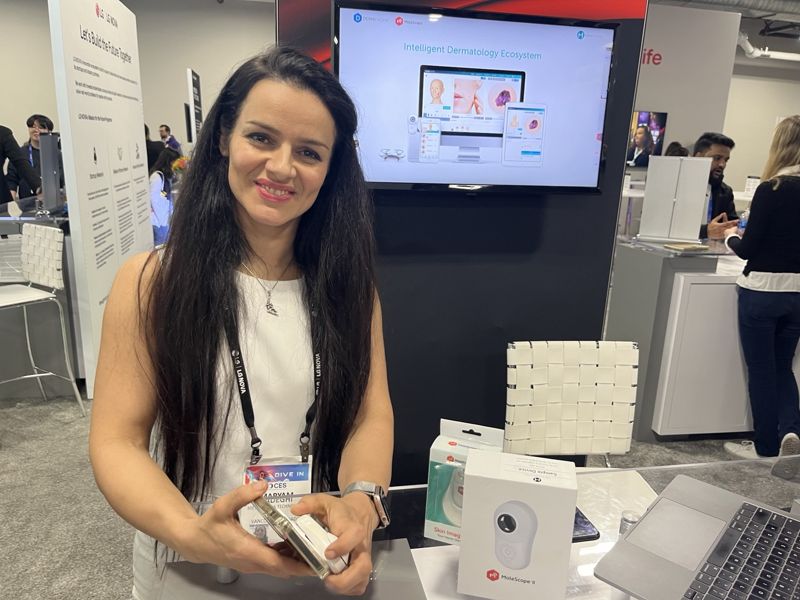 "휴머노이드 장착될 '로봇 손'부터 피부 암 진단 솔루션까지" 스타트업 열전 [CES 2025]