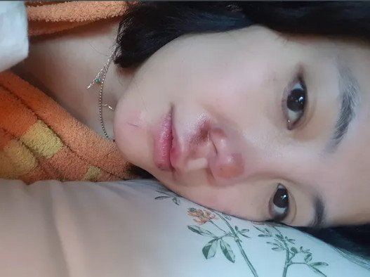 '코 재수술' 고은아, 안면 부상 이후 "내 앞니 우짜노"