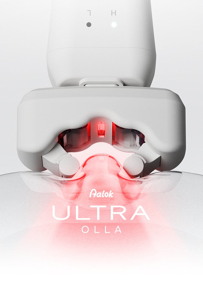 (사진=알록 제공) *재판매 및 DB 금지