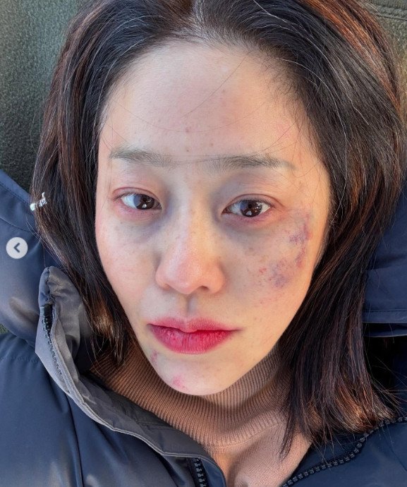 고현정, 시퍼런 멍투성이 얼굴…흰머리까지 '깜짝' [N샷]