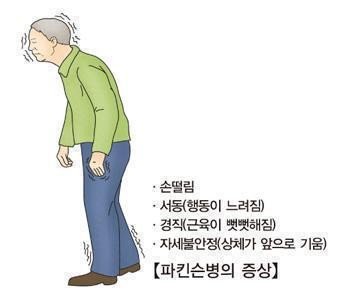 파킨슨병 (출처=연합뉴스)