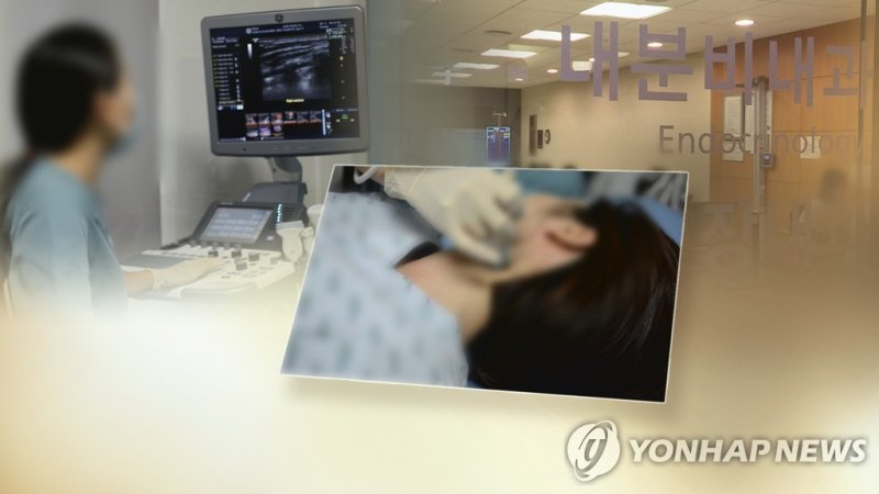 "'1㎝ 이하 갑상선암' 고주파절제술 효과·안전성 확인" (출처=연합뉴스)