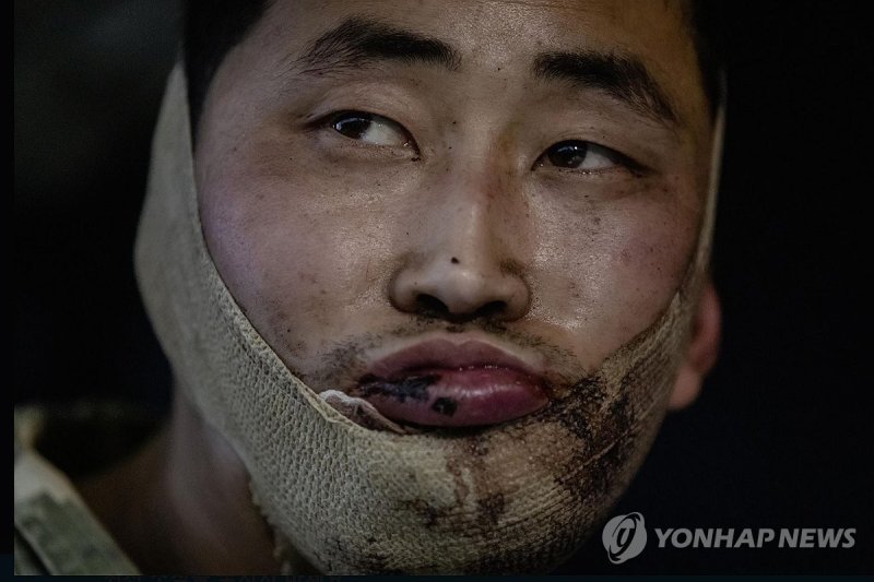 우크라이나군에 생포된 북한군 (출처=연합뉴스)