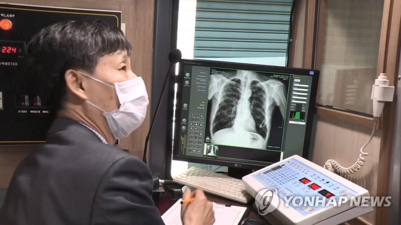 결핵 검진 (출처=연합뉴스)