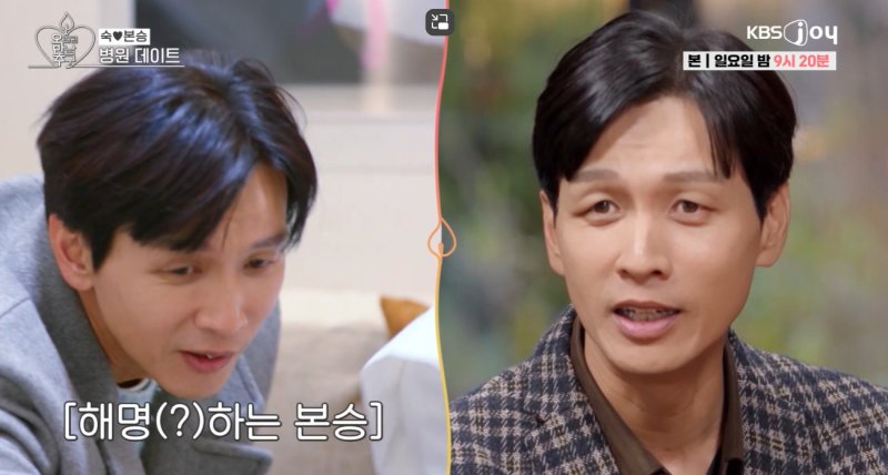 구본승, '처진 눈'은 필러 부작용…시술 후 업그레이드 된 외모