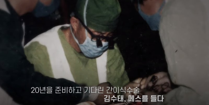 실제 수술 장면 (출처=연합뉴스)