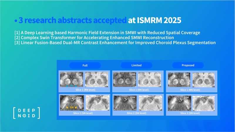 딥노이드, ISMRM 2025에서 퇴행성 뇌질환 연구 발표 “신경과학 AI분야 강자 입증”