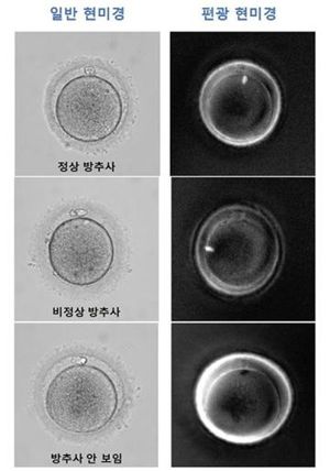 좋은문화병원 난임센터, 임신 성공률 높인다