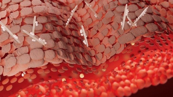 팹타이드가 스피큘과 결합해 피부 깊숙히 침투하는 모습(지샌달 제공)