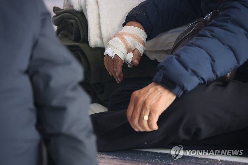 집에 붙은 불 끄다 화상입은 주민 (출처=연합뉴스)