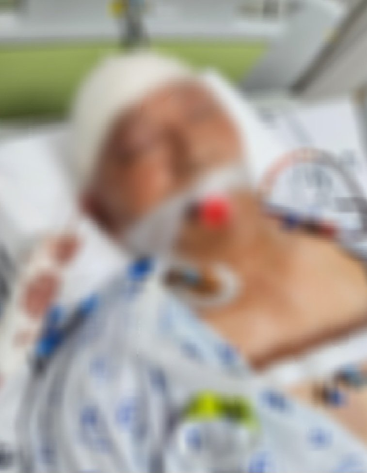 [서울=뉴시스] 보배드림에 올라온 폭행 이후 피해자의 모습이다 (사진=보배드림 캡쳐) 2025.04.06.photo@newsis.com *재판매 및 DB 금지